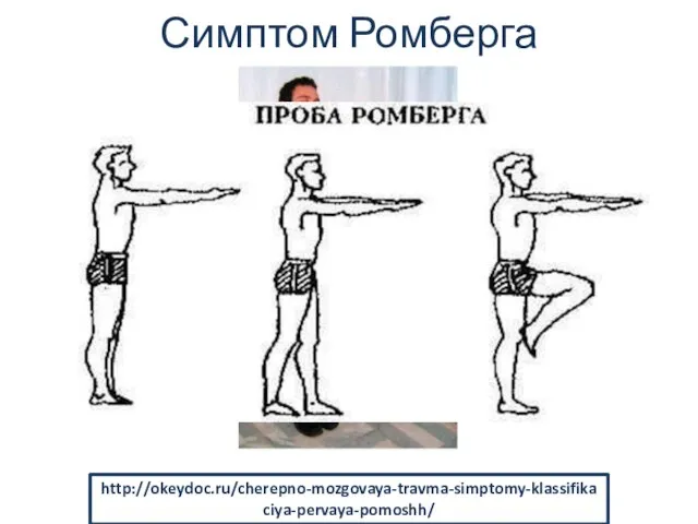 Симптом Ромберга http://edikst.ru/article/264711/poza-romberga---chto-eto-takoe-vestibulyarnaya-proba-v-poze-romberga http://okeydoc.ru/cherepno-mozgovaya-travma-simptomy-klassifikaciya-pervaya-pomoshh/