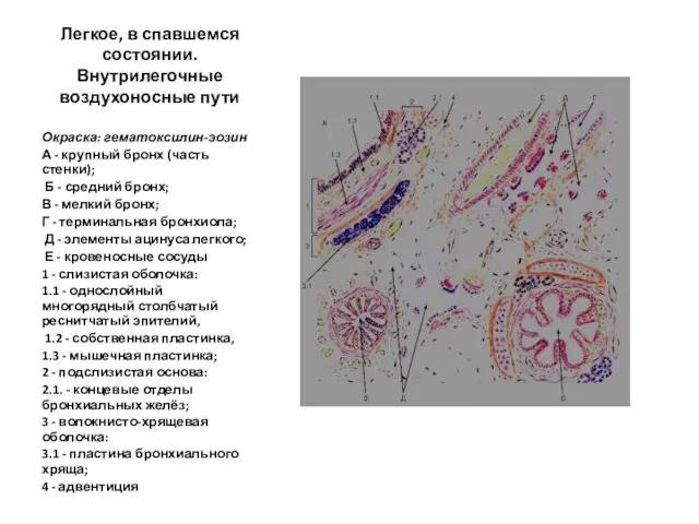 Легкое, в спавшемся состоянии. Внутрилегочные воздухоносные пути Окраска: гематоксилин-эозин А -