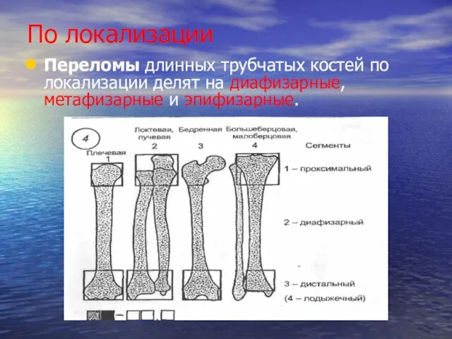 По локализации Переломы длинных трубчатых костей по локализации делят на диафизарные, метафизарные и эпифизарные.