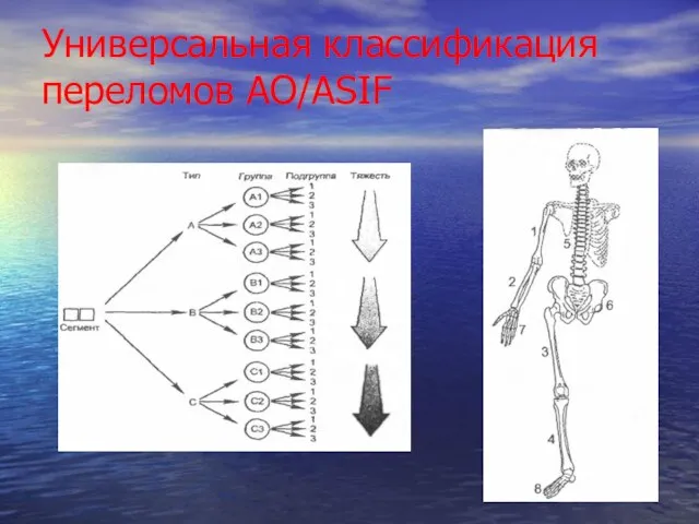 Универсальная классификация переломов АО/ASIF