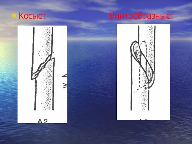 Косые: Винтообразные: