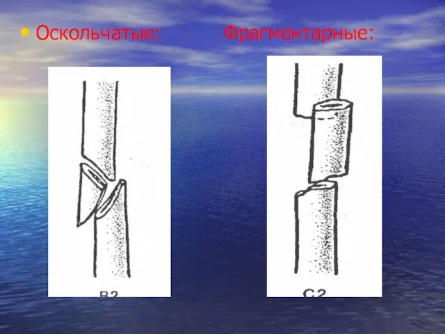 Оскольчатые: Фрагментарные: