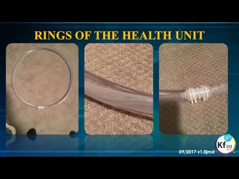 RINGS OF THE HEALTH UNIT