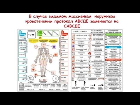 В случае видимом массивным наружным кровотечении протокол АВСДЕ заменяется на САВСДЕ