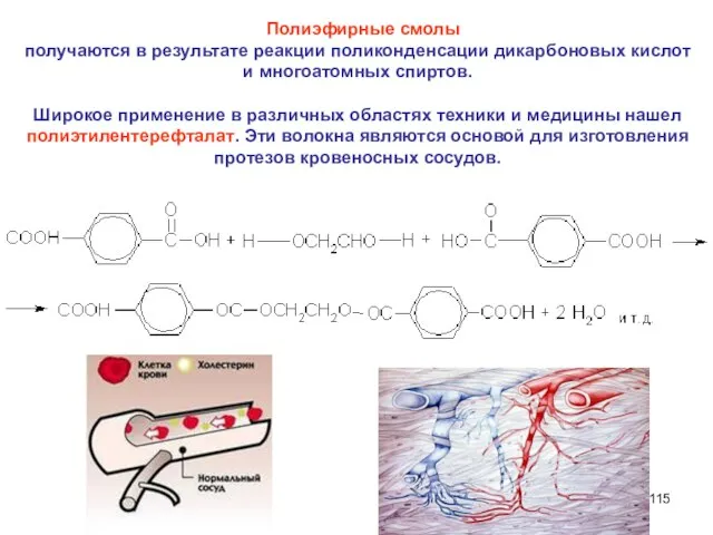 Полиэфирные смолы получаются в результате реакции поликонденсации дикарбоновых кислот и многоатомных