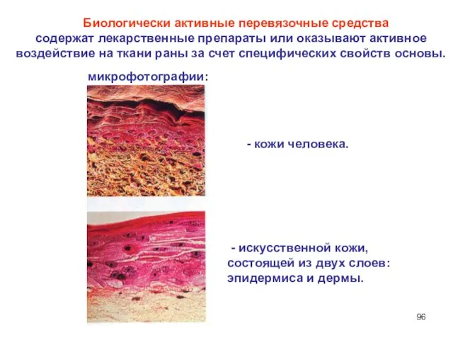 Биологически активные перевязочные средства содержат лекарственные препараты или оказывают активное воздействие
