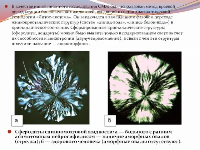 В качестве инновационного исследования СМЖ был использован метод краевой дегидратации биологических