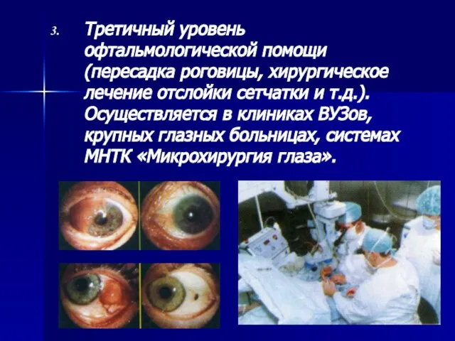 Третичный уровень офтальмологической помощи (пересадка роговицы, хирургическое лечение отслойки сетчатки и