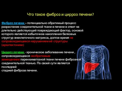 1 Что такое фиброз и цирроз печени? Фиброз печени – потенциально