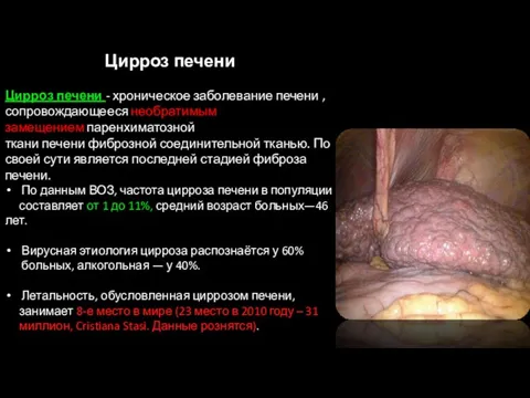 1 Цирроз печени Цирроз печени - хроническое заболевание печени , сопровождающееся