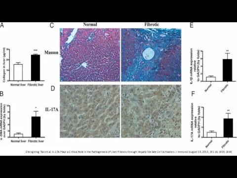 1 Zhongming Tan et al. IL-17A Plays a Critical Role in