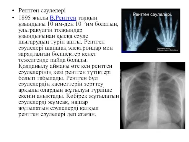 Рентген сәулелері 1895 жылы В.Рентген толқын ұзындығы 10 нм-ден 10−3нм болатын,