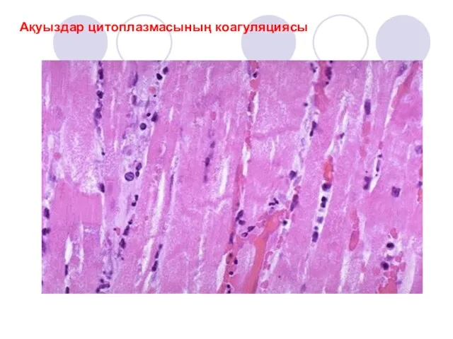 Ақуыздар цитоплазмасының коагуляциясы