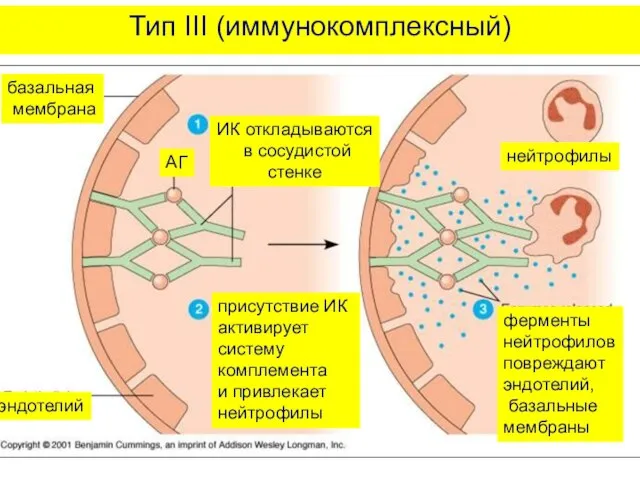 Тип III (иммунокомплексный) нейтрофилы ферменты нейтрофилов повреждают эндотелий, базальные мембраны базальная