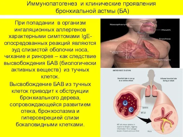 Иммунопатогенез и клинические проявления бронхиальной астмы (БА) При попадании в организм