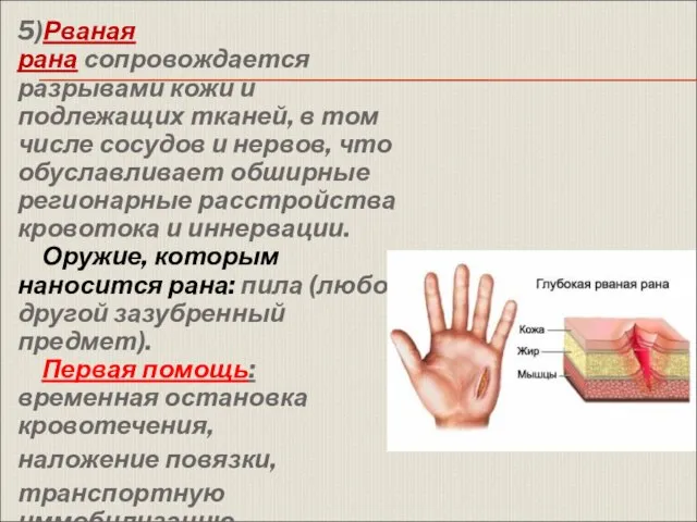 5)Рваная рана сопровождается разрывами кожи и подлежащих тканей, в том числе