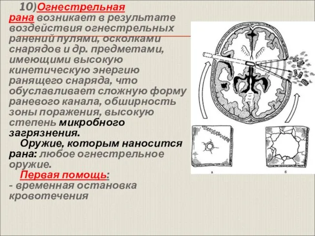 10)Огнестрельная рана возникает в результате воздействия огнестрельных ранений пулями, осколками снарядов