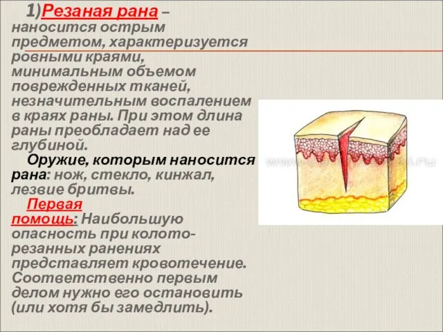 1)Резаная рана – наносится острым предметом, характеризуется ровными краями, минимальным объемом