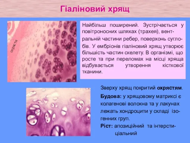 Гіаліновий хрящ Зверху хрящ покритий охрястям. Будова: у хрящовому матриксі є