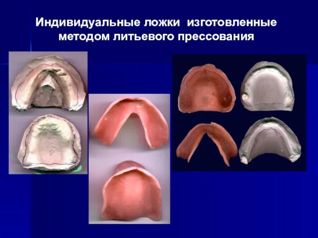 Индивидуальные ложки изготовленные методом литьевого прессования