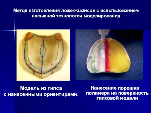 Метод изготовления ложек-базисов с использованием насыпной технологии моделирования Нанесение порошка полимера