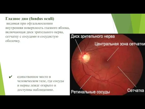 Глазное дно (fundus oculi) видимая при офтальмоскопии внутренняя поверхность глазного яблока,