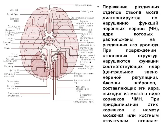 Поражение различных отделов ствола мозга диагностируется по нарушению функций черепных нервов