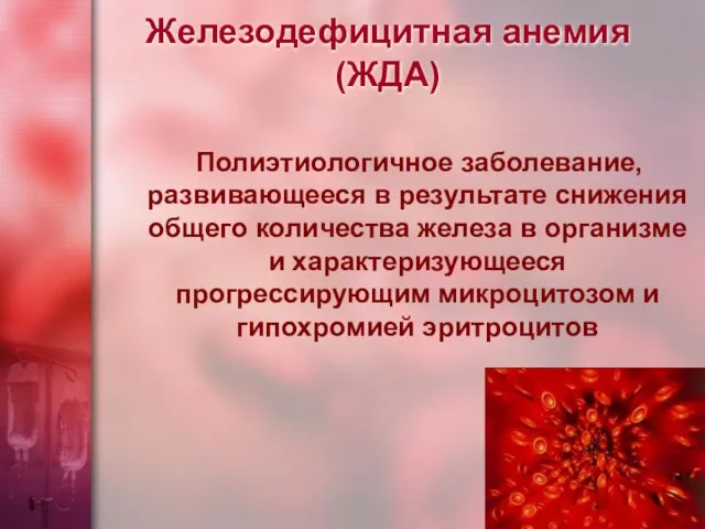 Железодефицитная анемия (ЖДА) Полиэтиологичное заболевание, развивающееся в результате снижения общего количества