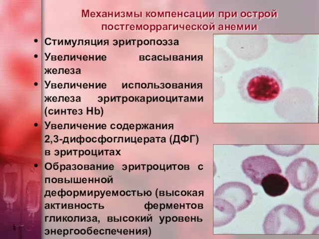 Механизмы компенсации при острой постгеморрагической анемии Стимуляция эритропоэза Увеличение всасывания железа