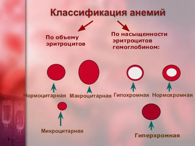 По объему эритроцитов Классификация анемий По насыщенности эритроцитов гемоглобином: Микроцитарная Нормоцитарная Макроцитарная Нормохромная Гипохромная Гиперхромная