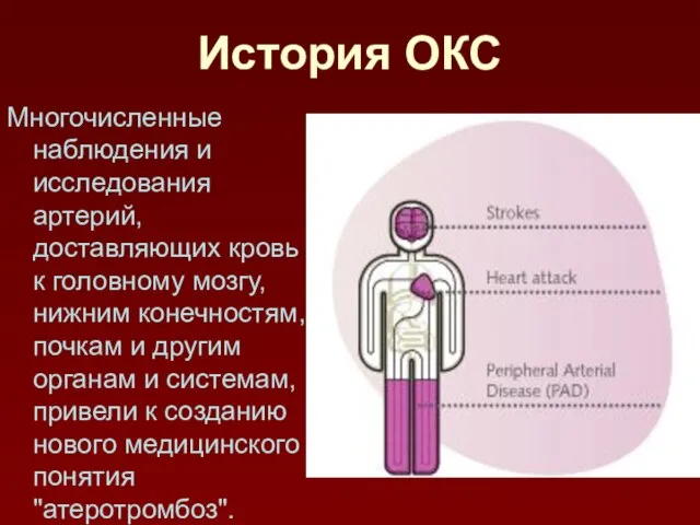 История ОКС Многочисленные наблюдения и исследования артерий, доставляющих кровь к головному