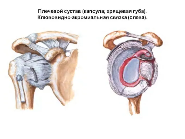 Плечевой сустав (капсула; хрящевая губа). Клювовидно-акромиальная связка (слева).