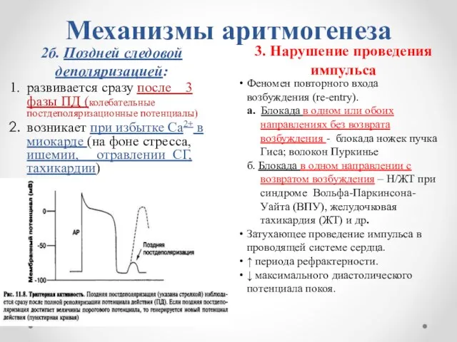 Механизмы аритмогенеза 2б. Поздней следовой деполяризацией: 3. Нарушение проведения импульса развивается