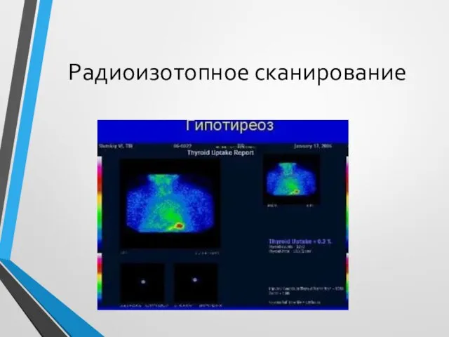 Радиоизотопное сканирование