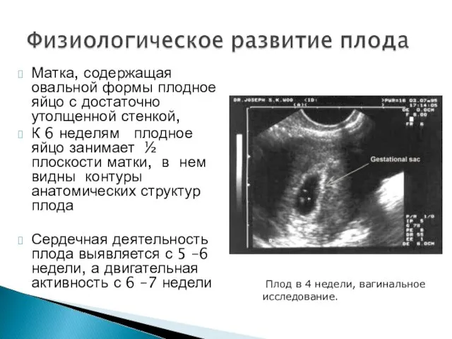 Матка, содержащая овальной формы плодное яйцо с достаточно утолщенной стенкой, К