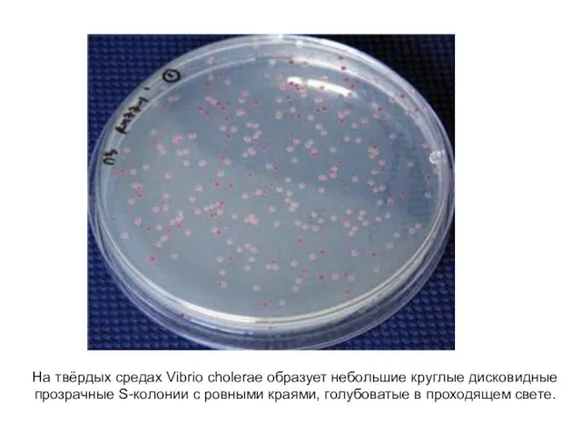 На твёрдых средах Vibrio cholerae образует небольшие круглые дисковидные прозрачные S-колонии