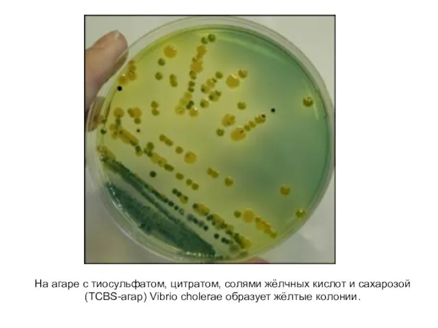 На агаре с тиосульфатом, цитратом, солями жёлчных кислот и сахарозой (TCBS-агар) Vibrio cholerae образует жёлтые колонии.