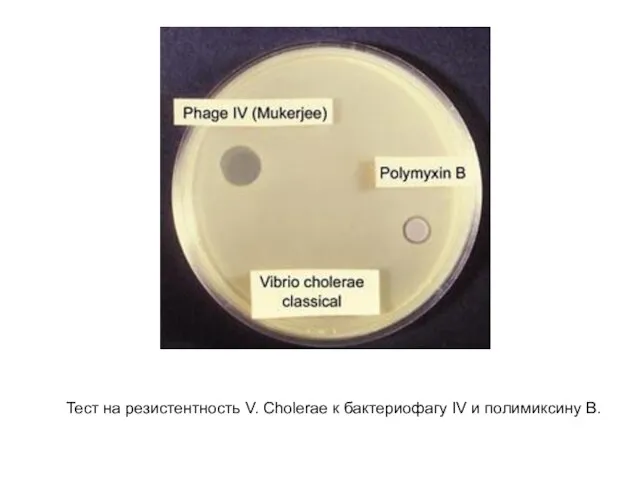 Тест на резистентность V. Cholerae к бактериофагу IV и полимиксину В.