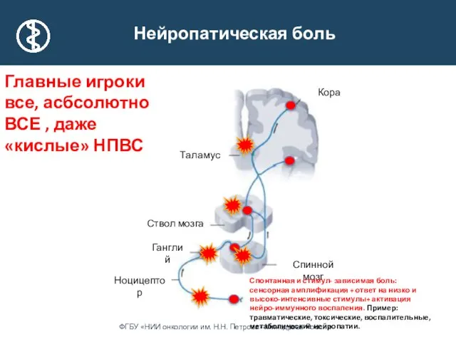 Таламус Ганглий Ствол мозга Кора Ноцицептор Спинной мозг Нейропатическая боль Спонтанная