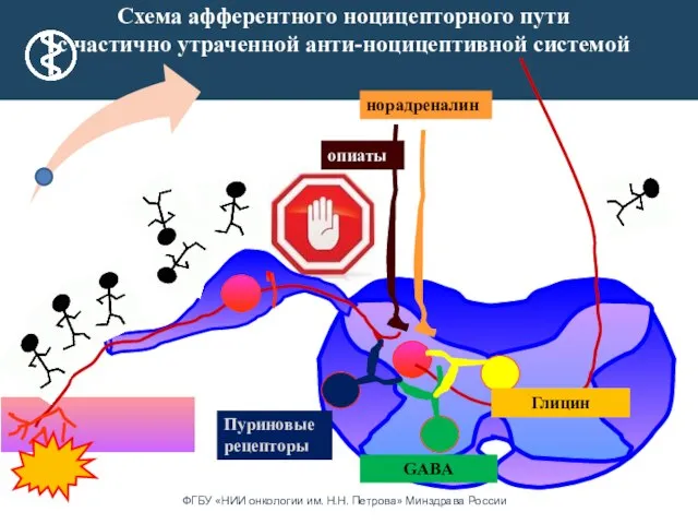 Схема афферентного ноцицепторного пути с частично утраченной анти-ноцицептивной системой опиаты норадреналин GABA Глицин Пуриновые рецепторы