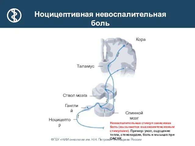 Таламус Ганглий Ствол мозга Кора Ноцицептор Спинной мозг Ноцицептивная невоспалительная боль