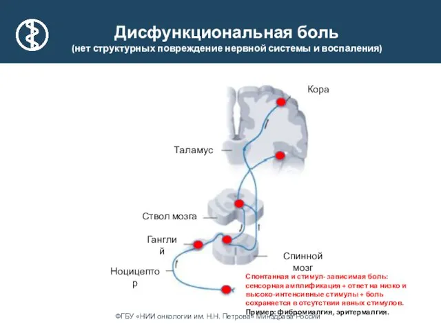 Таламус Ганглий Ствол мозга Кора Ноцицептор Спинной мозг Дисфункциональная боль (нет