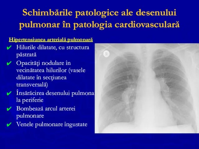 Schimbările patologice ale desenului pulmonar în patologia cardiovasculară Hipertensiunea arterială pulmonară
