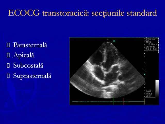 ECOCG transtoracică: secţiunile standard Parasternală Apicală Subcostală Suprasternală