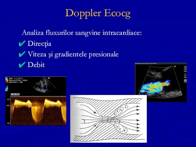 Doppler Ecocg Analiza fluxurilor sangvine intracardiace: Direcţia Viteza şi gradientele presionale Debit