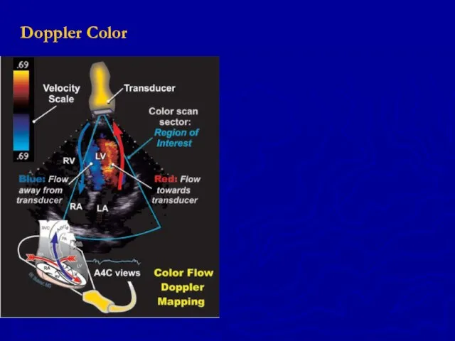 Doppler Color