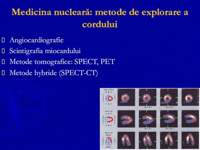 Medicina nucleară: metode de explorare a cordului Angiocardiografie Scintigrafia miocardului Metode