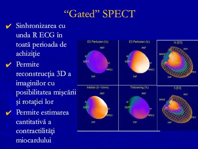 “Gated” SPECT Sinhronizarea cu unda R ECG în toată perioada de