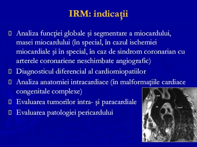 IRM: indicaţii Analiza funcţiei globale şi segmentare a miocardului, masei miocardului