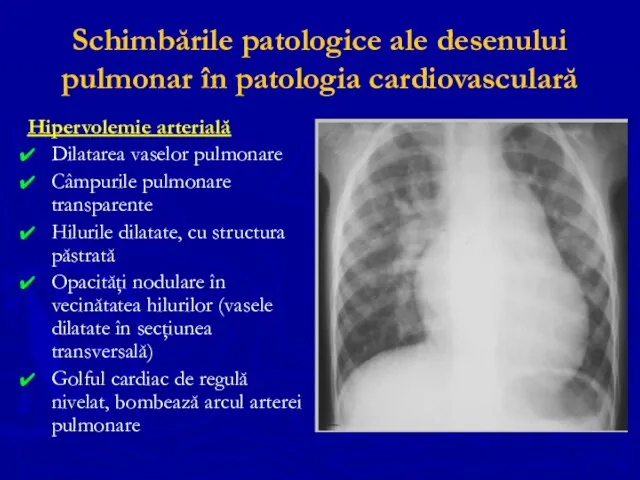 Schimbările patologice ale desenului pulmonar în patologia cardiovasculară Hipervolemie arterială Dilatarea